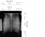 pelvis_1